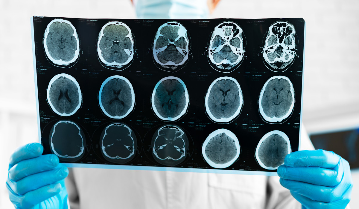 Cognitive Marketing: How to Build Deeper Customer Connections