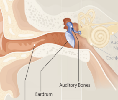 4 Types of Hearing Loss